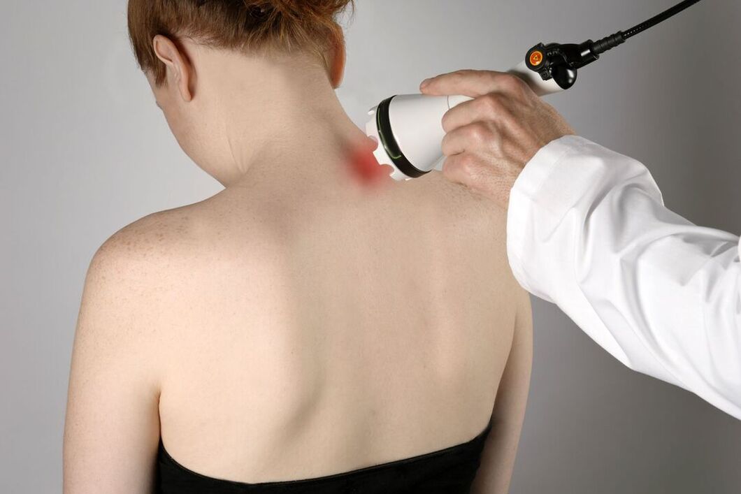 Physiotherapeutic treatment of cervical osteochondrosis