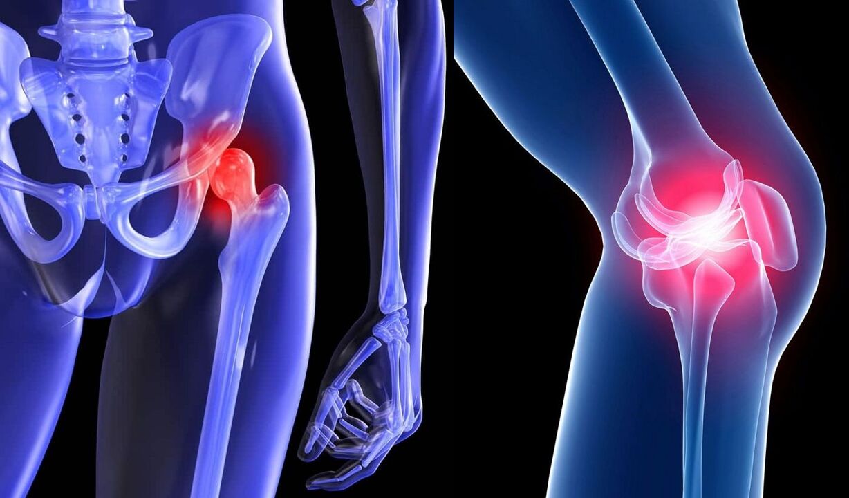 Symptoms of joint pain