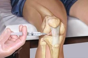 Injection also