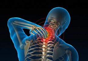 Why develops and how cervical osteochondrosis manifests itself
